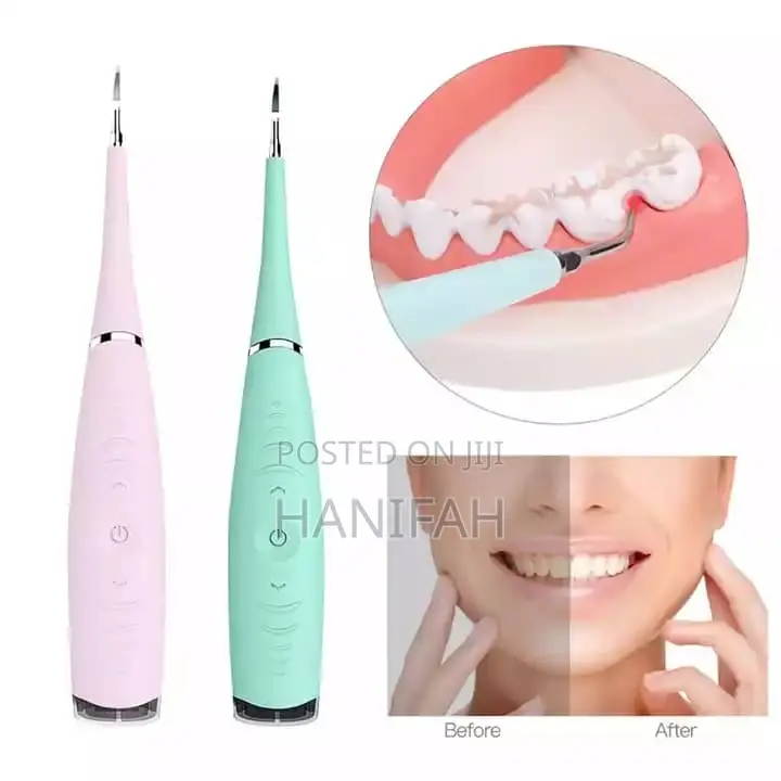 Sonic Dental Pic / Calculus Remover