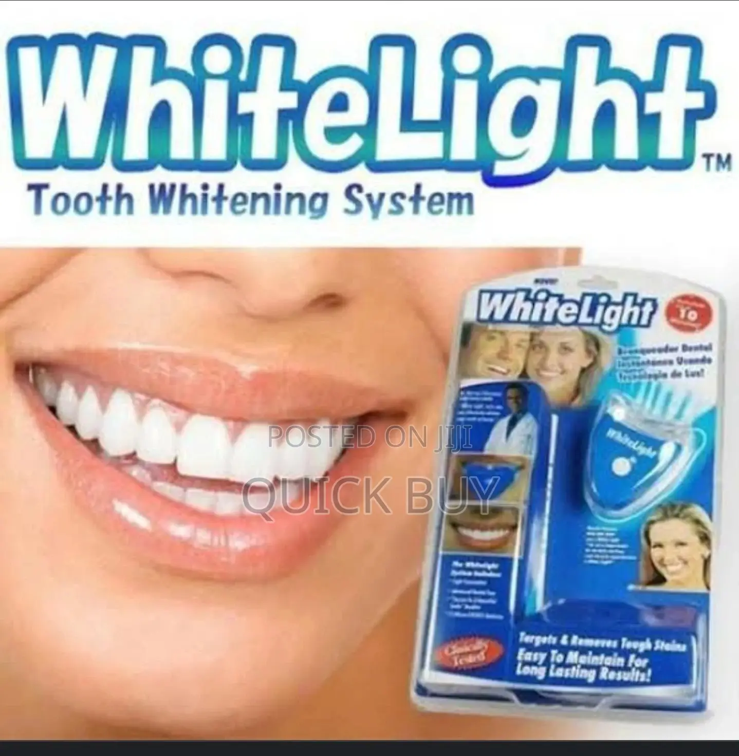 Whitelight Teeth Whitening Kit