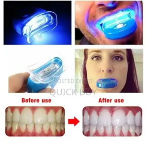 Whitelight Teeth Whitening Kit