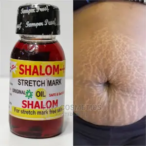 ORIGINAL Shalom OIL 14 Days Stretch Marks Wipeout Oil