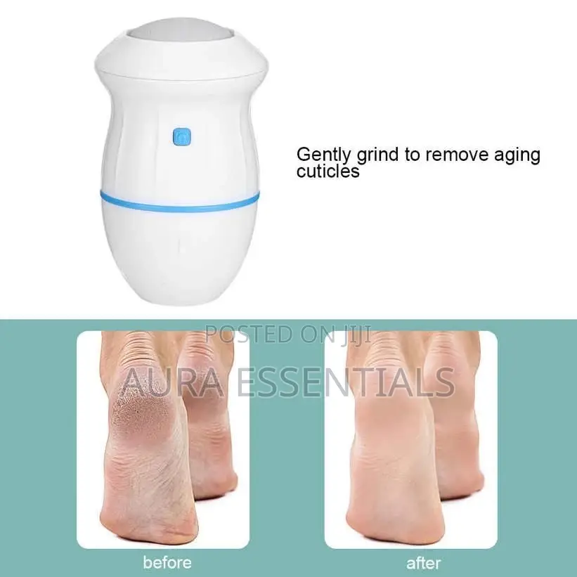 Callus Remover