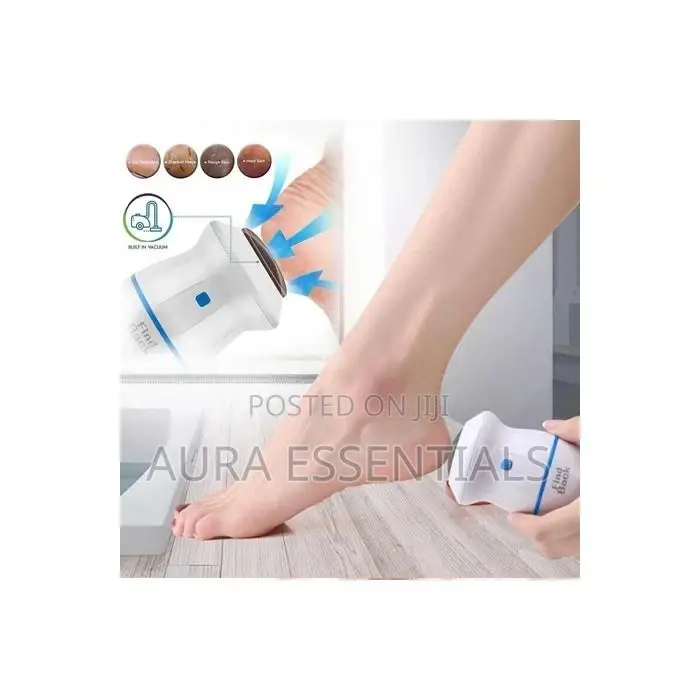 Callus Remover