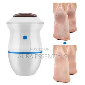 Callus Remover