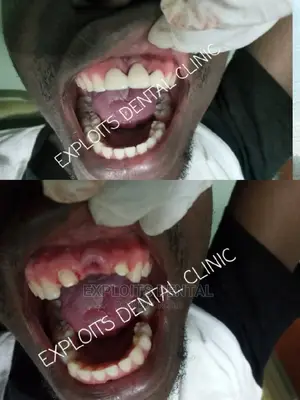 We Offer All Dental Services