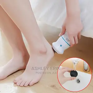Callus Remover