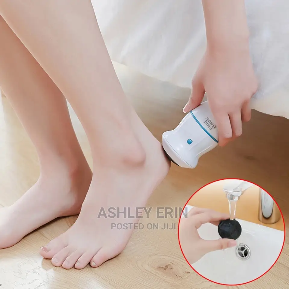 Callus Remover