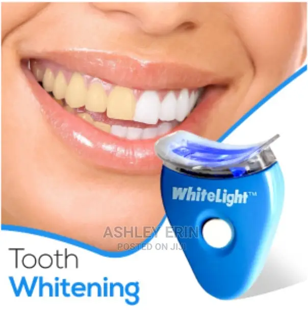 Portable Teeth Whitner