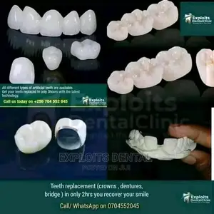 Teeth Replacement ( Artificial Teeth)
