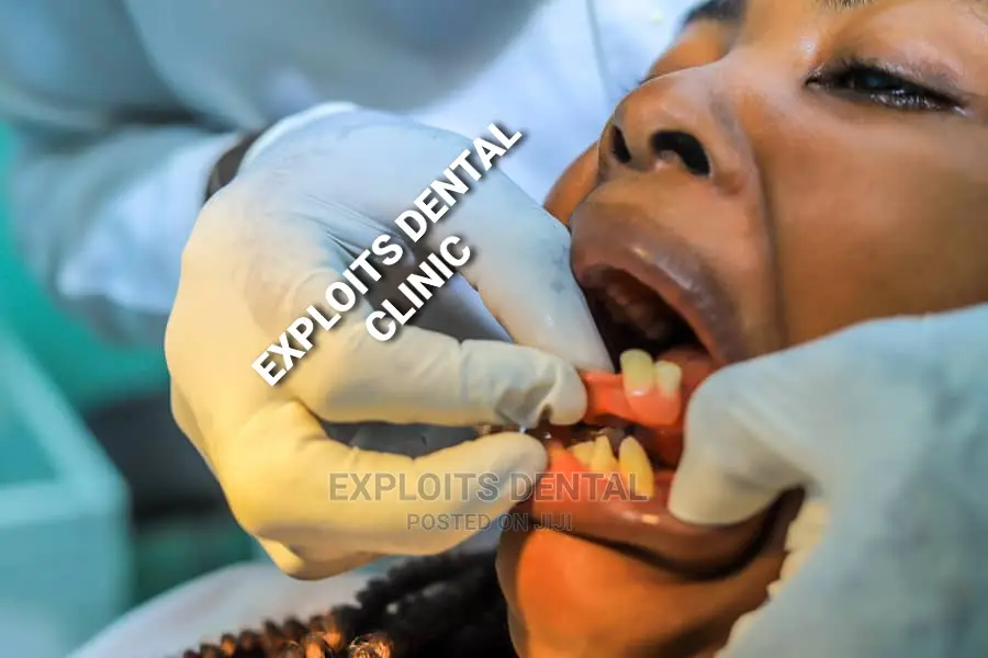 Removable Denture ,Crowns ,Bridges