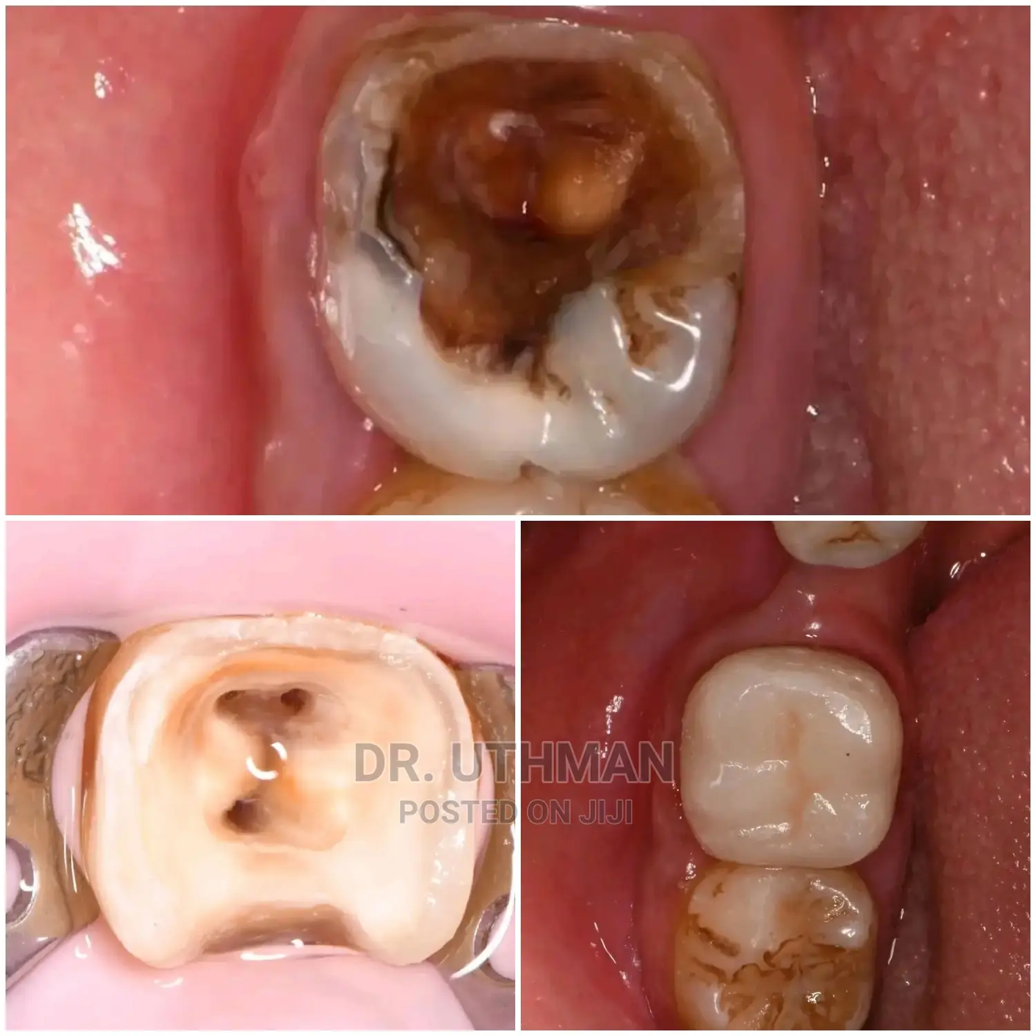 Dr.Uthuman ( Dental Care Services)