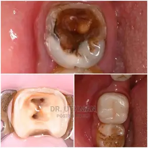 Dr.Uthuman ( Dental Care Services)