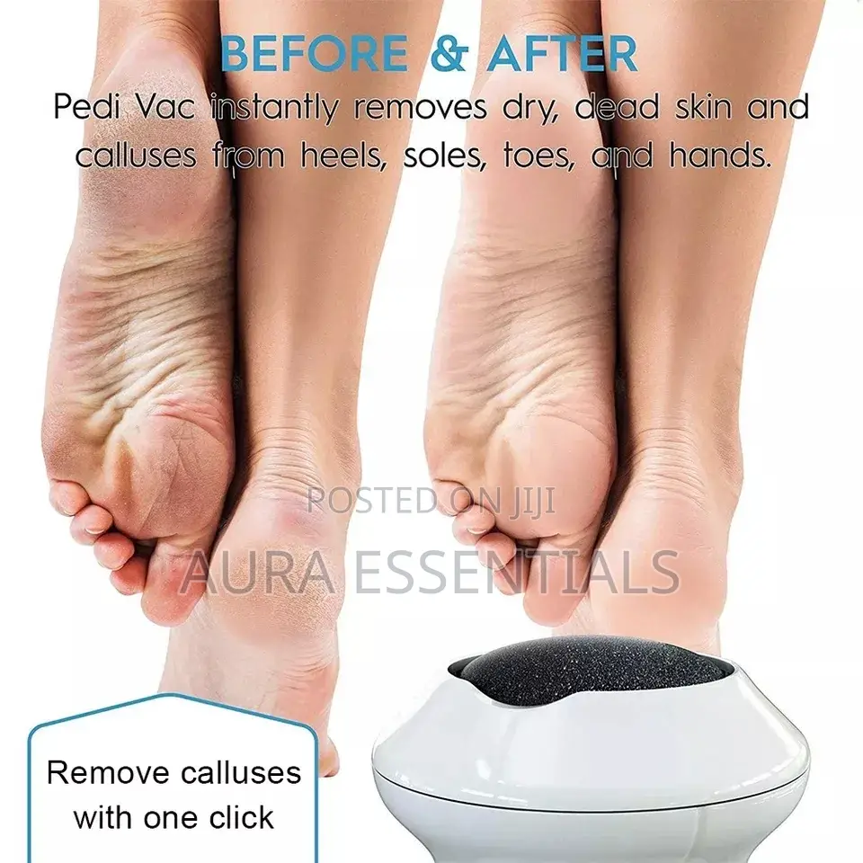 Electric Foot Grinder