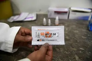 HIV Virus Testing Expert - Professional Experienced