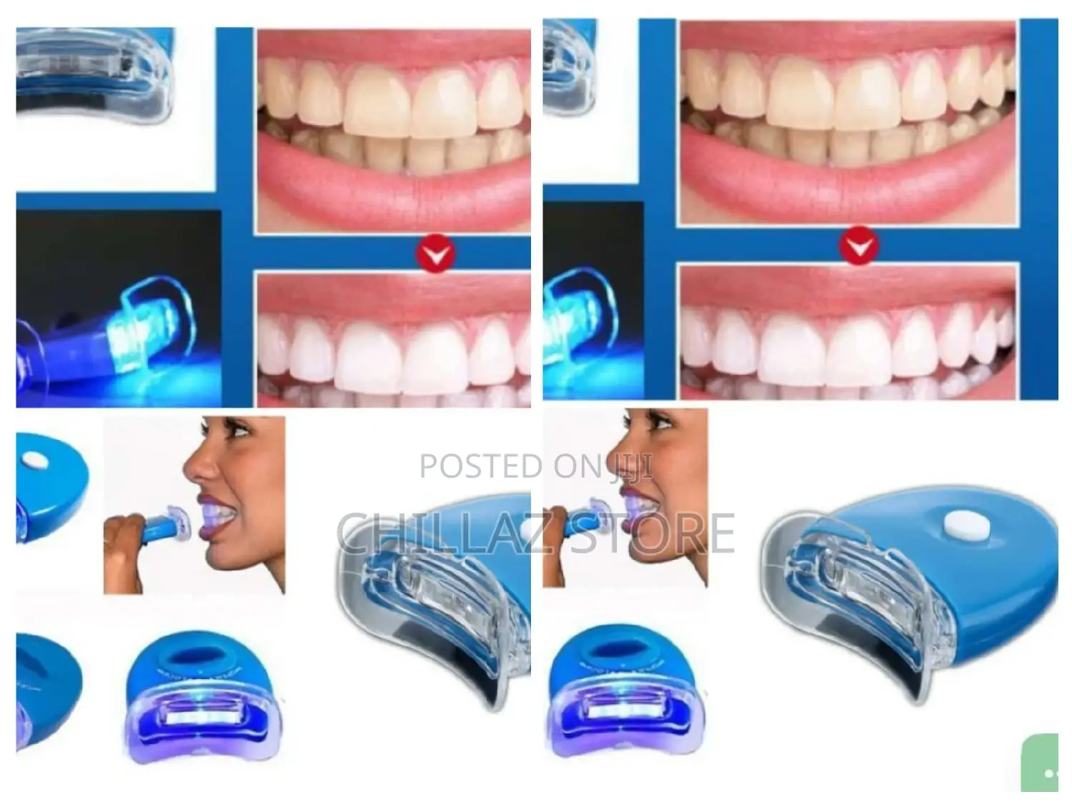 Teeth Whitening Light.