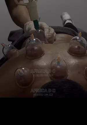Wet Cuping Service