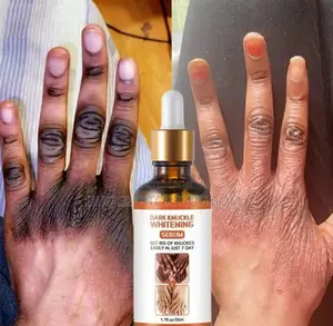 Black Fingers Dark Knees Dark Knuckle Remover