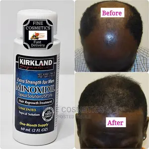 Minoxidil 5% Extra Strength Hair Regrowth Treatment for Men