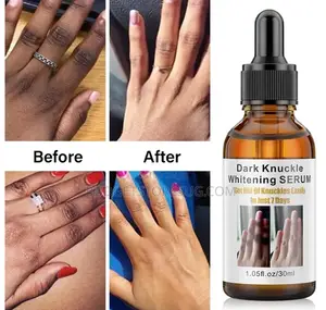 Whitening Serum Elbow Knuckles Underarm Dark Remover