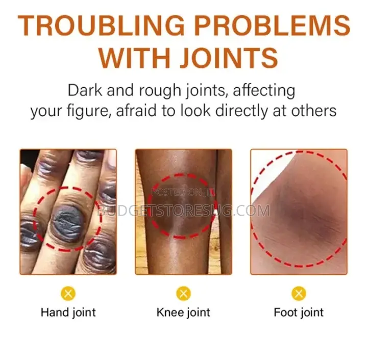Remove Dark Knuckle Elbow Knee Strong Dark Knuckle