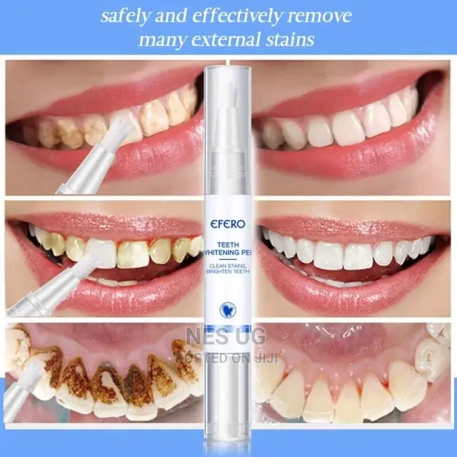 Instant Teeth Whitening Pen Strong on Stains Brightens Teeth