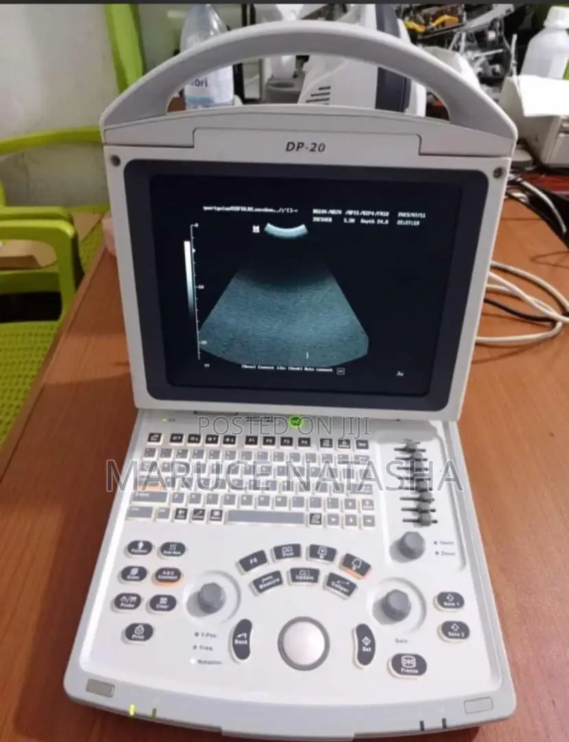 Portable Ultrasound Scan