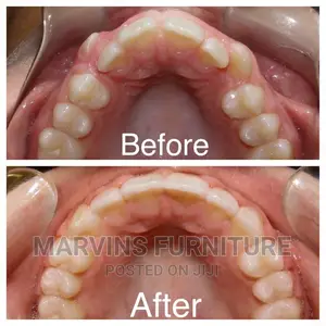 For All Your Dental Probrems
