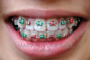 Dental Braces