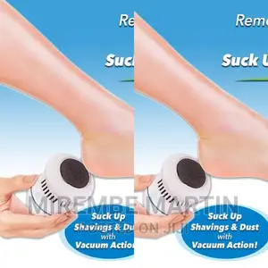 Portable Calluses Remover