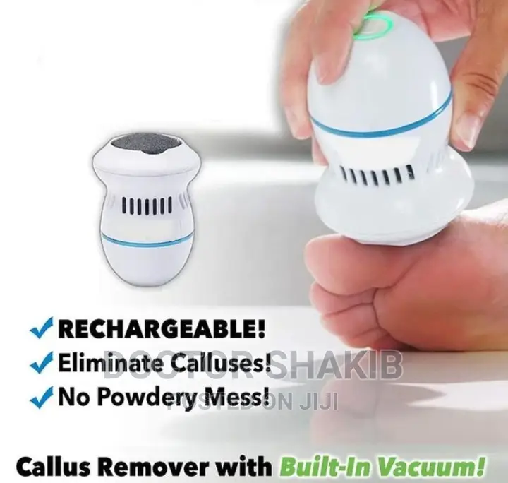 Motorized Electric Callus Remover