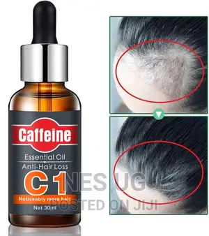 Essential Oil Anti-hair Loss Oil Anti-baldness