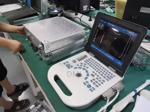Portable Ultrasound Scan (Back Up Battery)