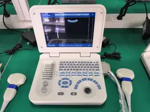 Brand New Laptop Size Ultrasound With a Printer and It’S Bag