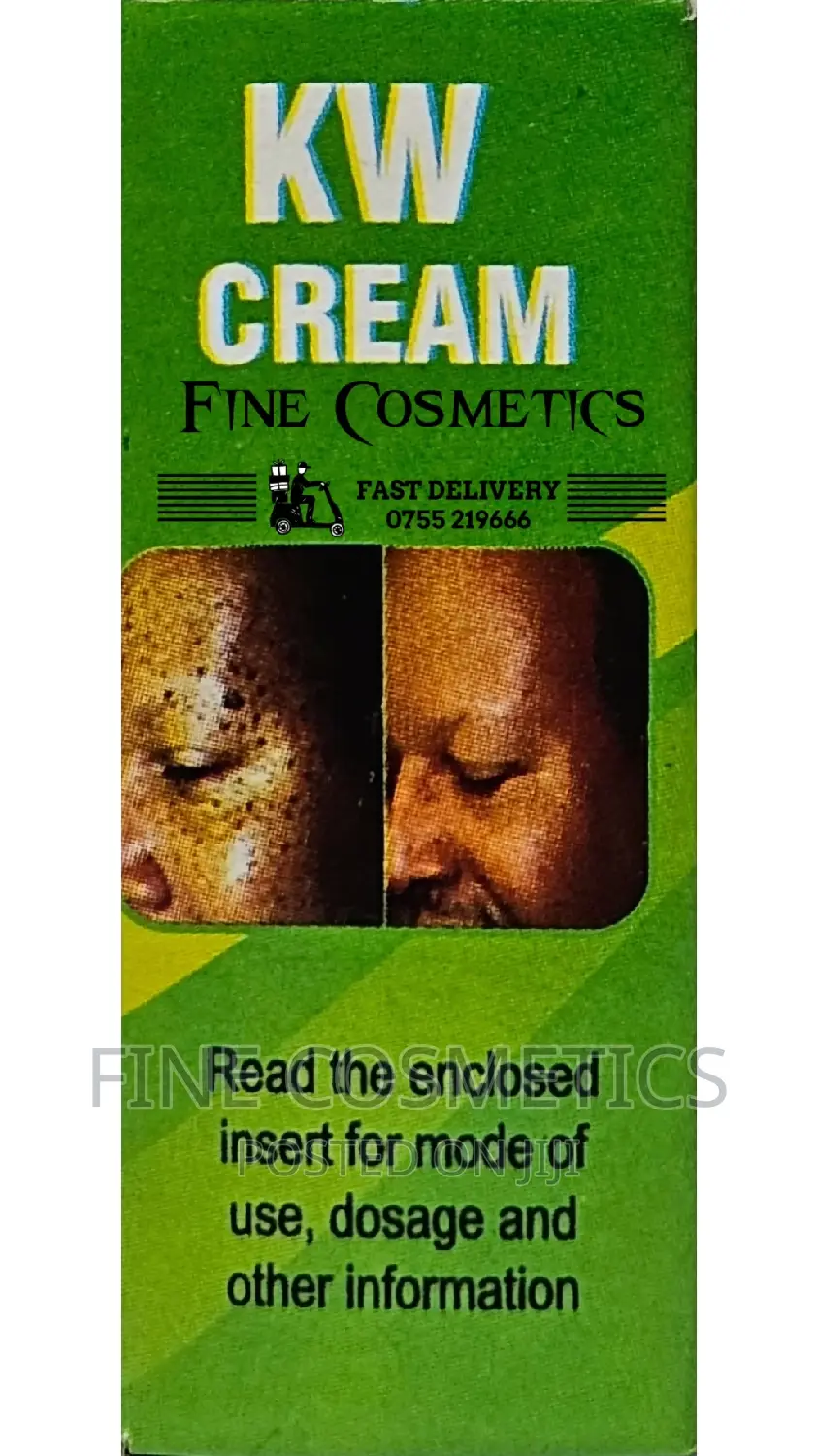 KING WARTS Remover- Maximum Strength Skin Tags Eraser Cream.