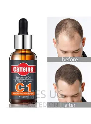 Caffeine C1 Anti Hair Loss Essential Oil 30ml