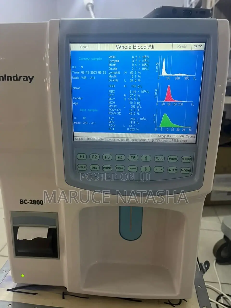 Refurbished Fully Automated CBC Machine
