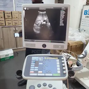 Ultrasound Machine (Color Doppler)