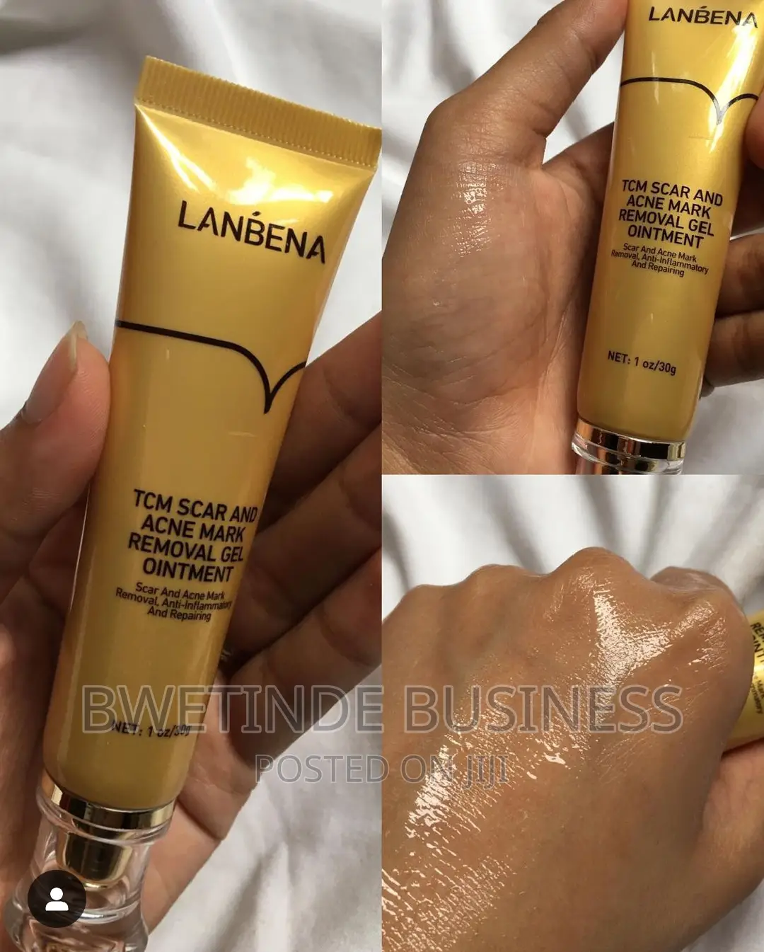 Scar Removal Gel for Old Scars and Gel Removal