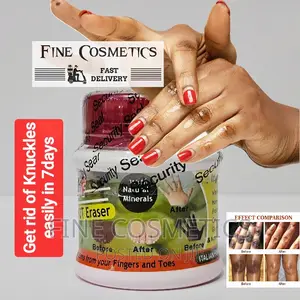 Spot Off |Dark Knuckle Remover Cream Care for Feet and Knees