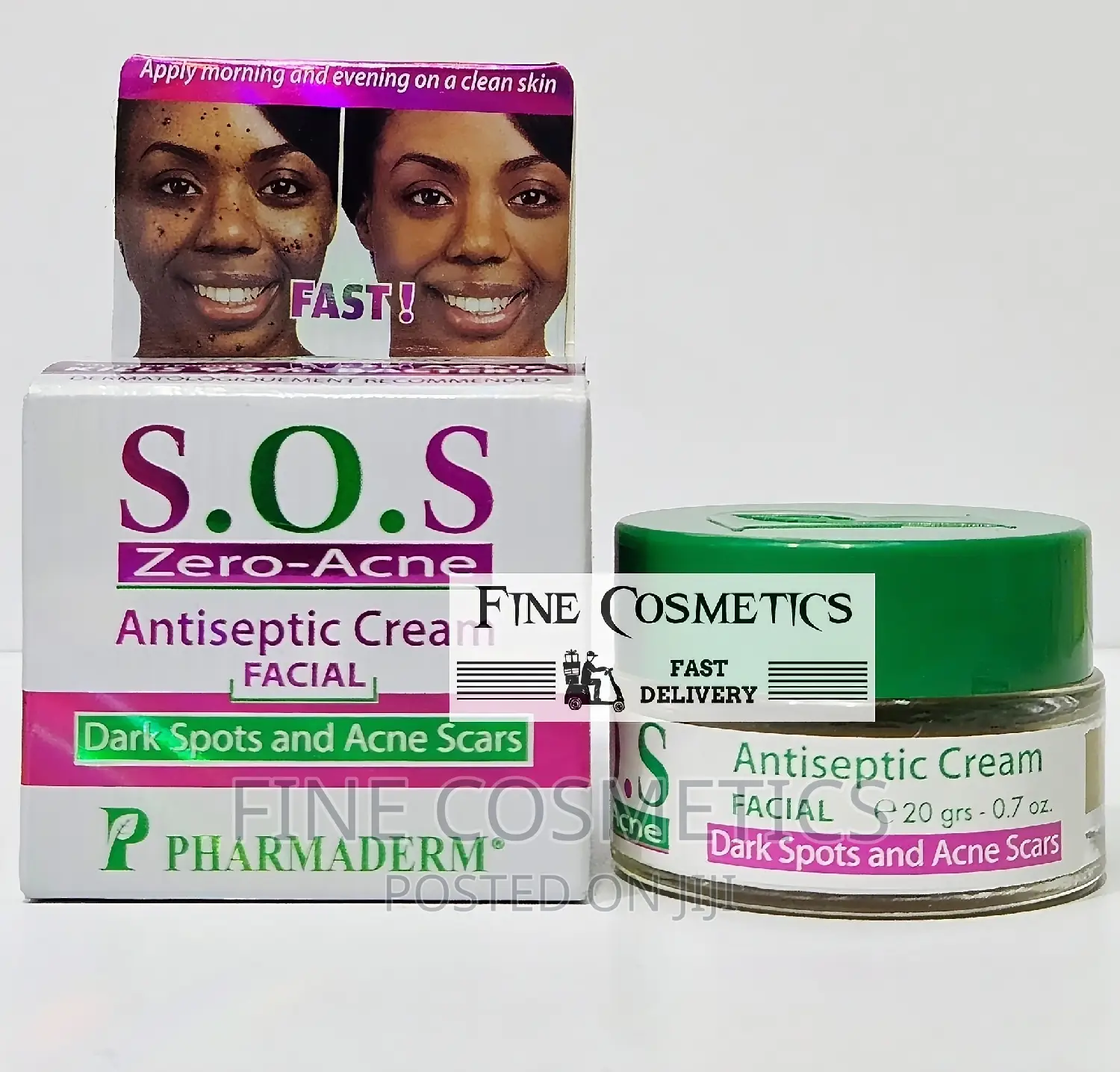 S.O.S Zero Acne | Pimple Fighter Black Spots Remover Cream.