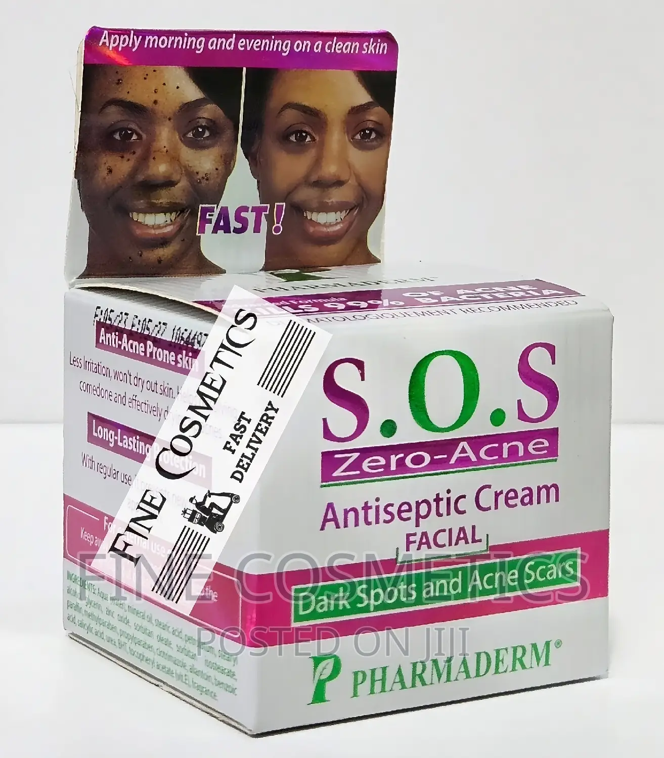 S.O.S Zero Acne | Pimple Fighter Black Spots Remover Cream.