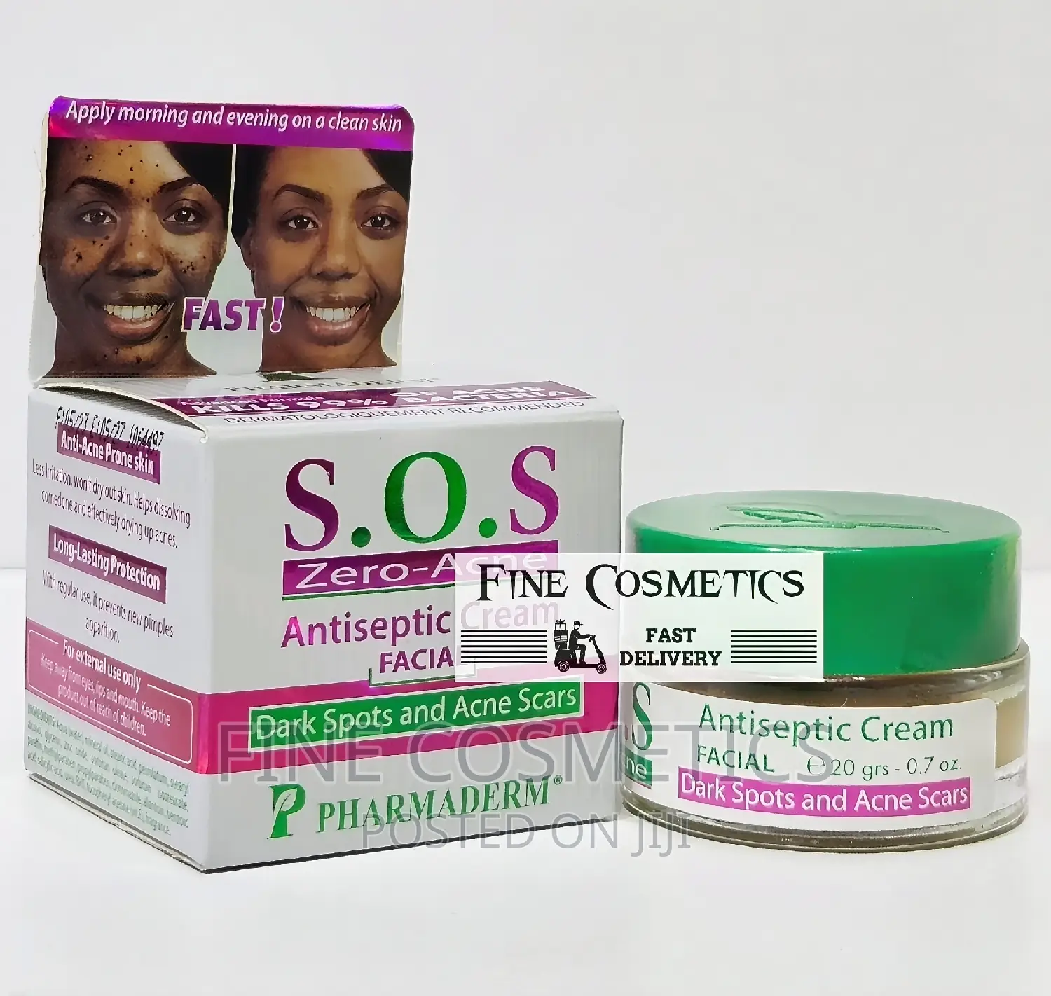 S.O.S Zero Acne | Pimple Fighter Black Spots Remover Cream.