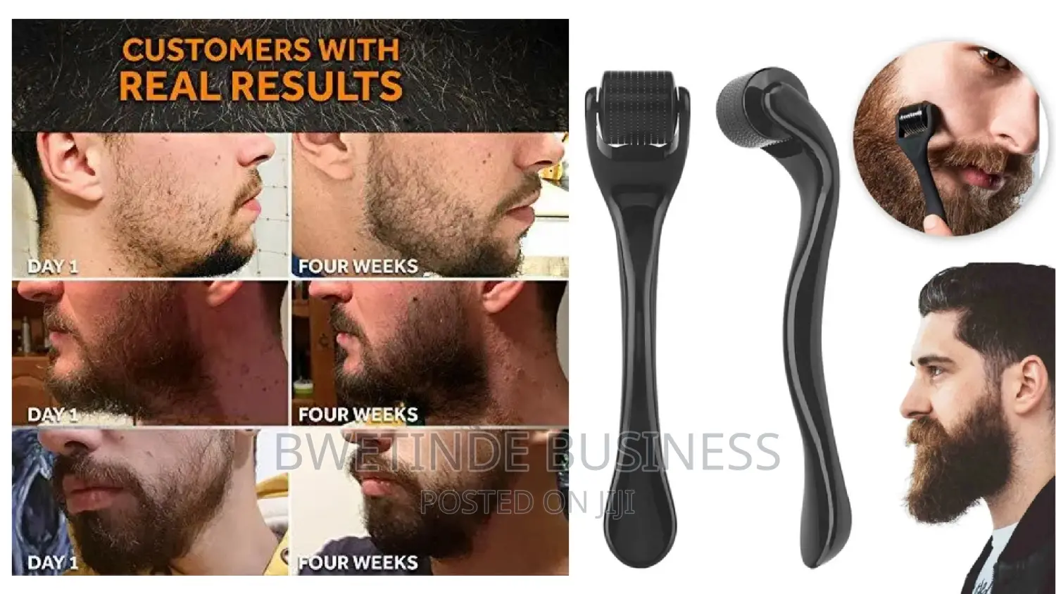 Beard Derma Roller for Beard Growth 0.5MM BEARD ROLLER