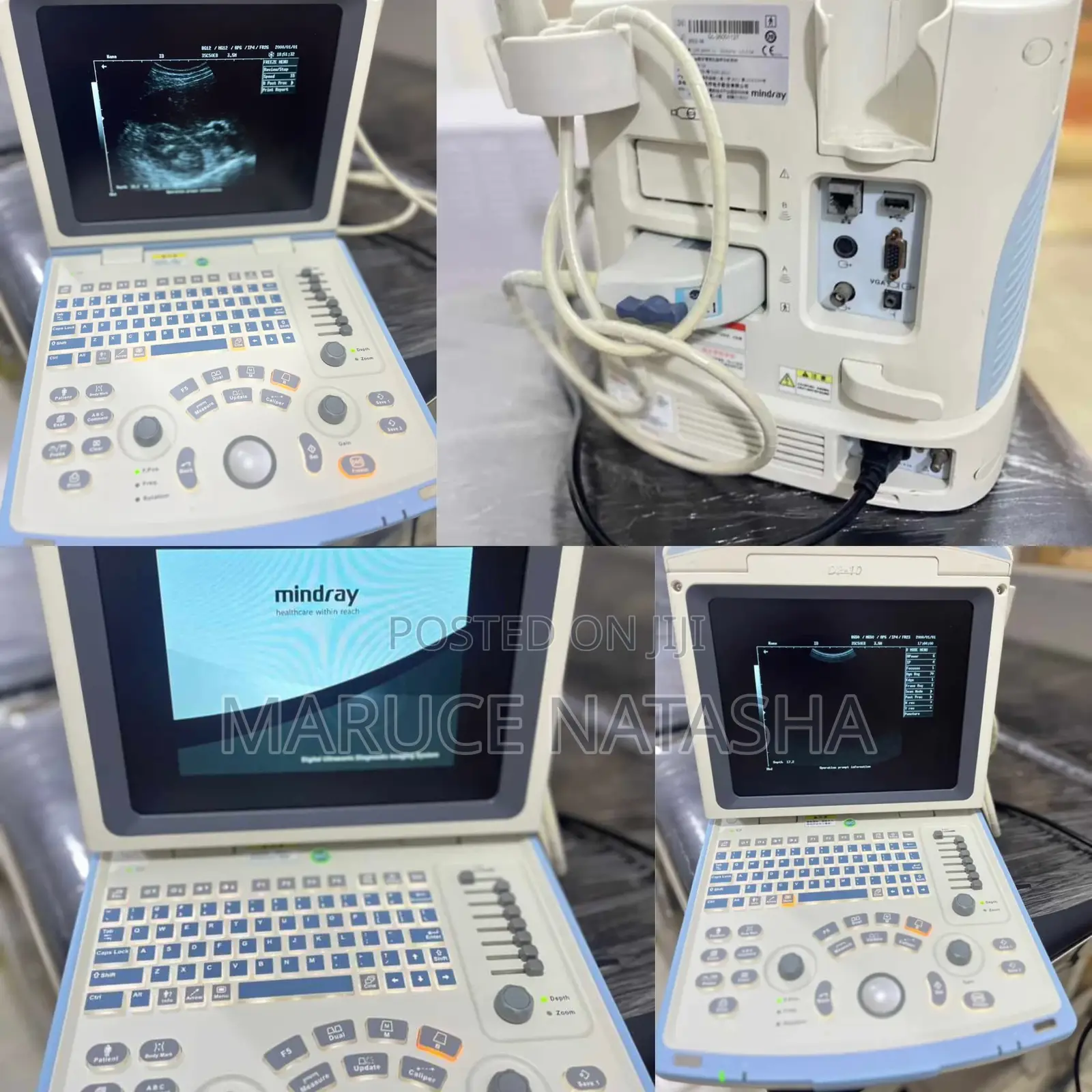Refurbished Mindray Dp 10