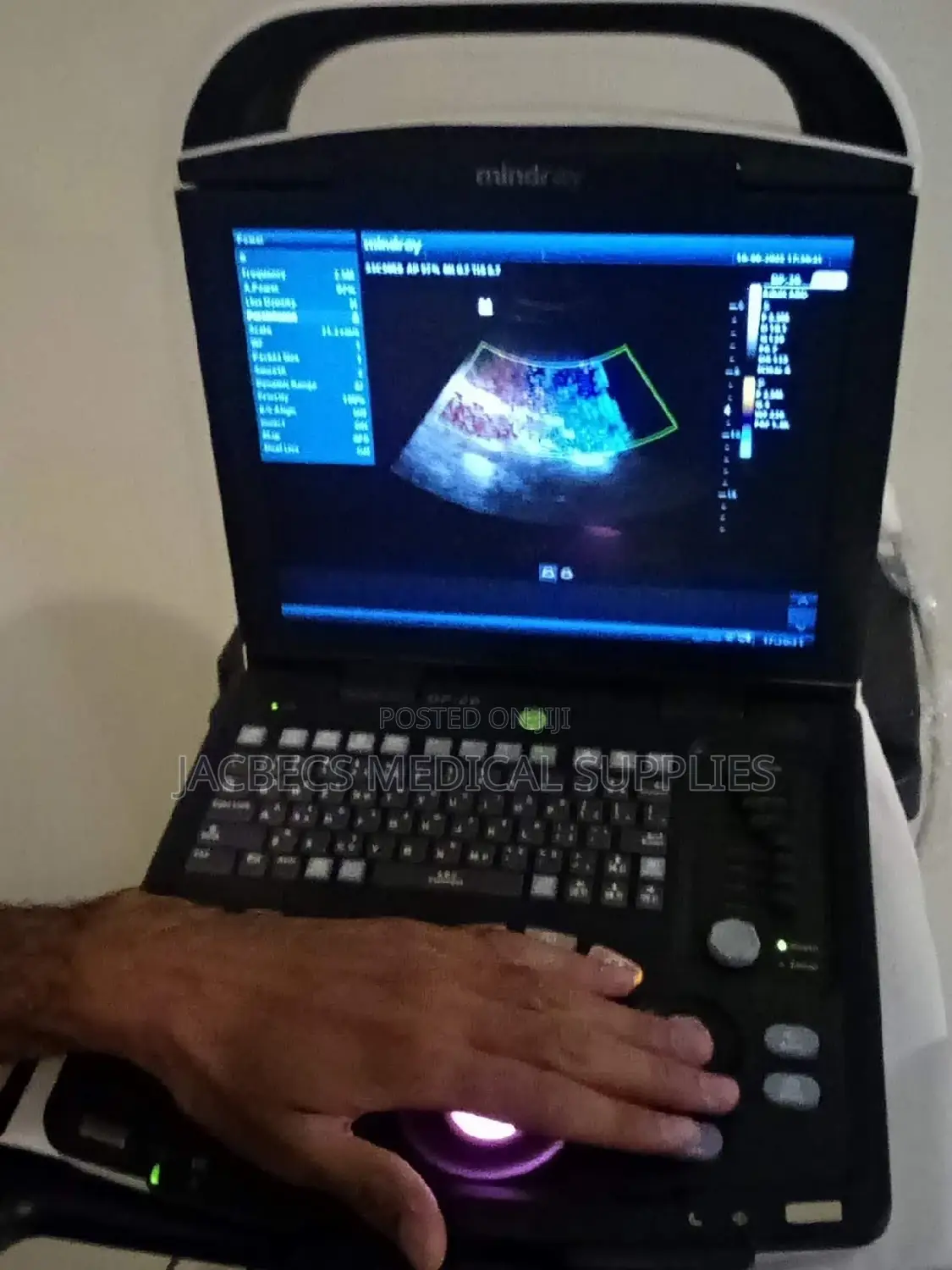 Dp10 Scan Mindray