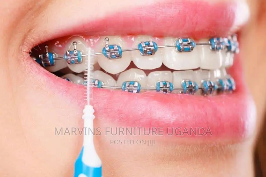Teeth Braces