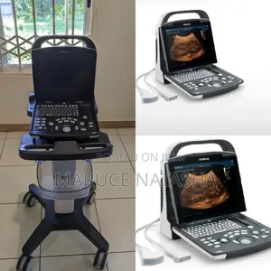 Brand New Dp 10 Ultrasound Scan Machine