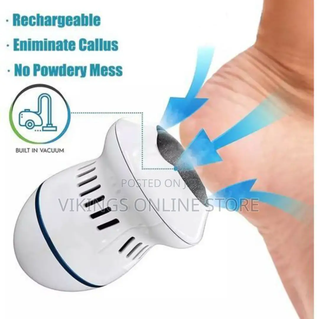 Electric Foot File Callus Remover Pedicure - White.