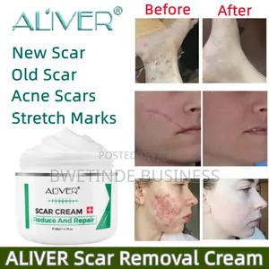 Scar Removal 50g