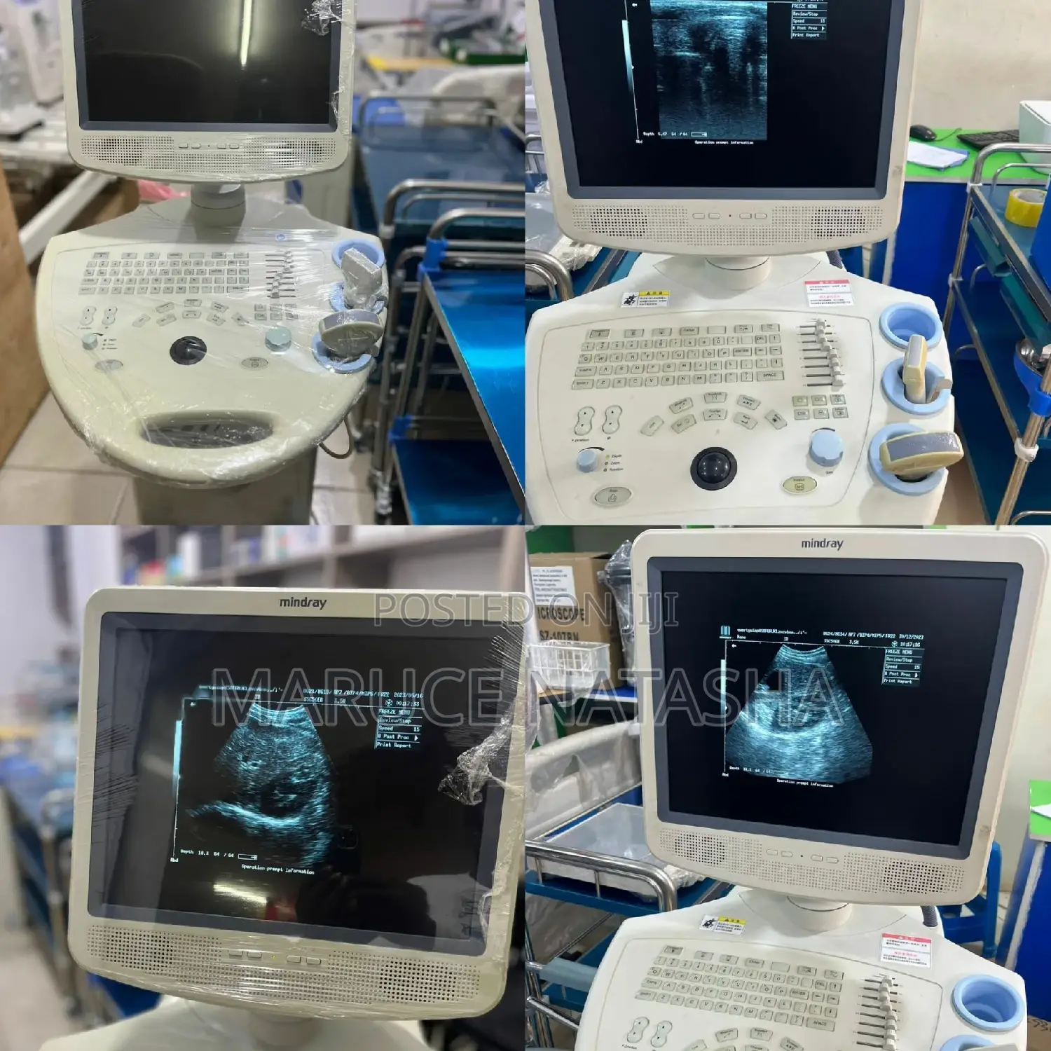 Mindray Dp 7700 Ultrasound Scan