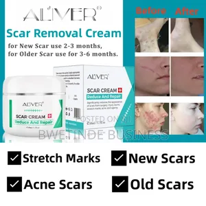 Quick Effective Scar Remover Cream for Various Scars
